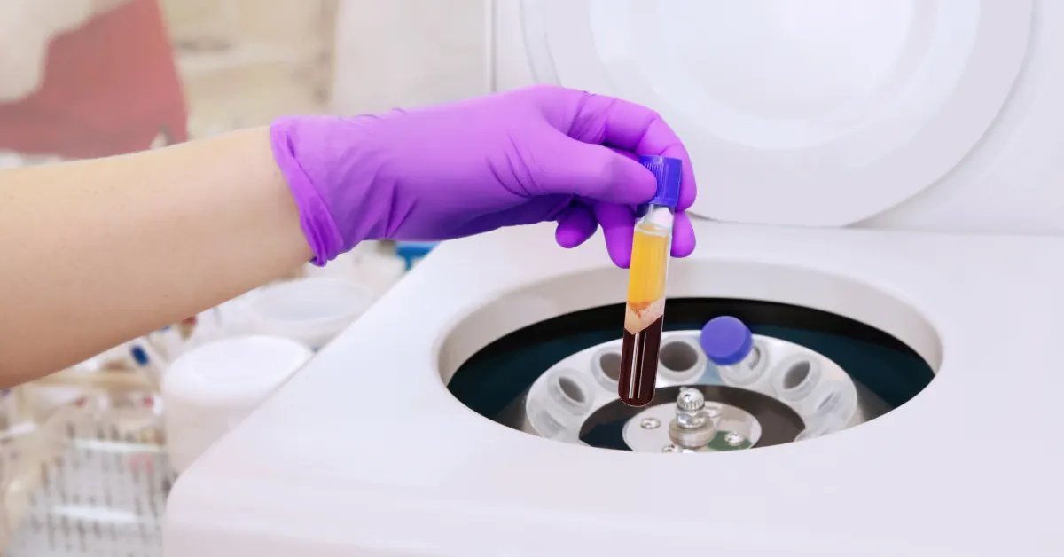 Gloved technician placing a separated blood sample into a laboratory centrifuge